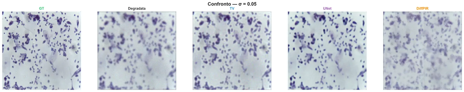Side by side comparison of a cytology image: ground truth, degraded input, and the Total Variation, UNet and DiffPIR reconstructions at noise level 0.05
